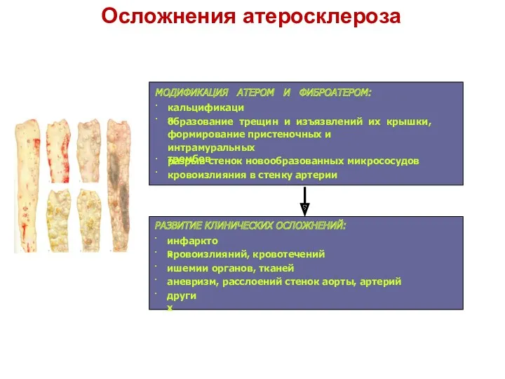 Осложнения атеросклероза