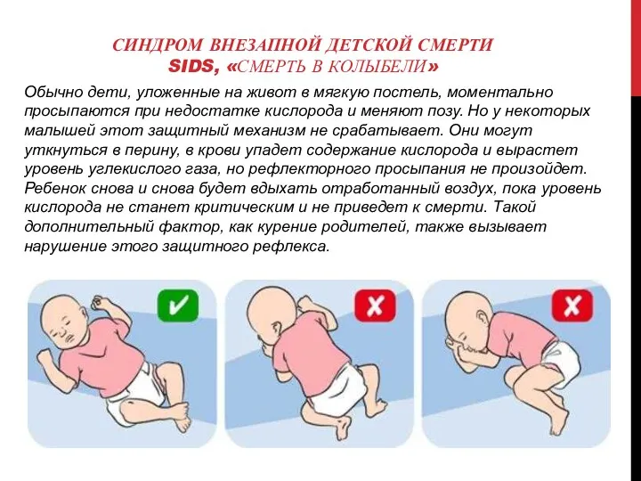 СИНДРОМ ВНЕЗАПНОЙ ДЕТСКОЙ СМЕРТИ SIDS, «СМЕРТЬ В КОЛЫБЕЛИ» Обычно дети,