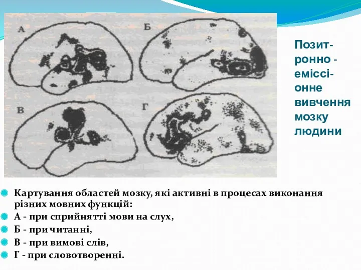 Позит- ронно - еміссі- онне вивчення мозку людини Картування областей