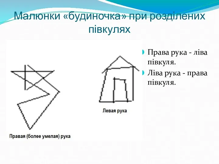 Малюнки «будиночка» при розділених півкулях Права рука - ліва півкуля. Ліва рука - права півкуля.