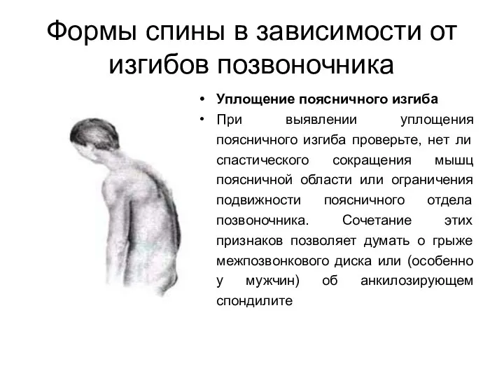 Формы спины в зависимости от изгибов позвоночника Уплощение поясничного изгиба