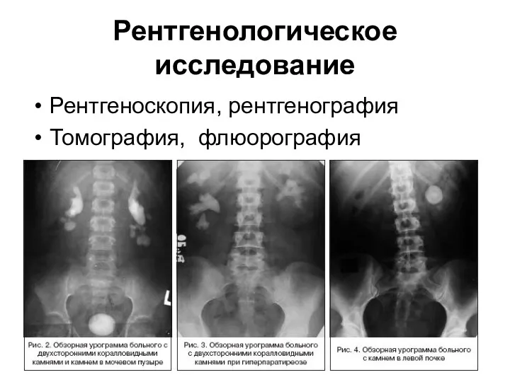 Рентгенологическое исследование Рентгеноскопия, рентгенография Томография, флюорография