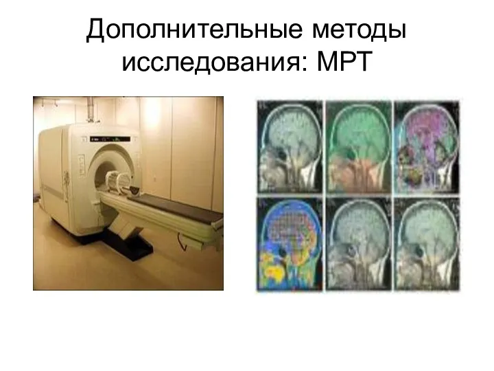 Дополнительные методы исследования: МРТ