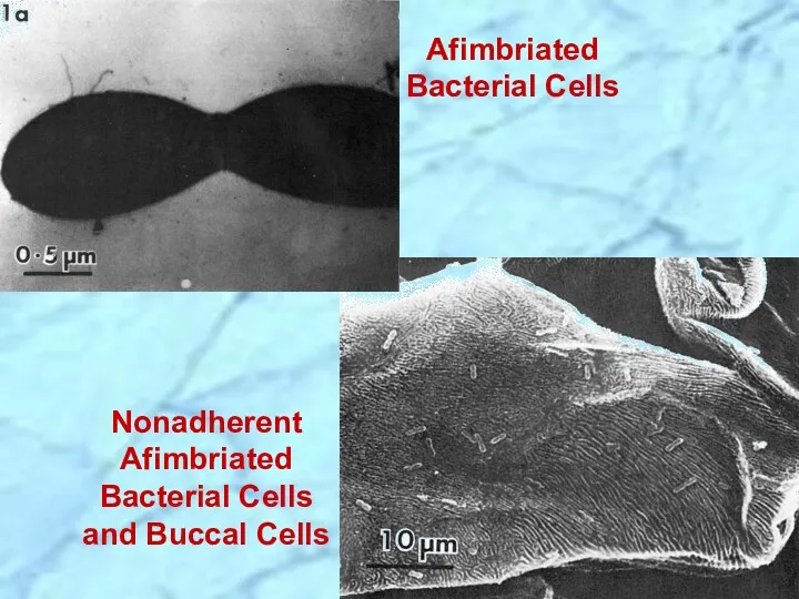 Afimbriated Bacterial Cells Nonadherent Afimbriated Bacterial Cells and Buccal Cells