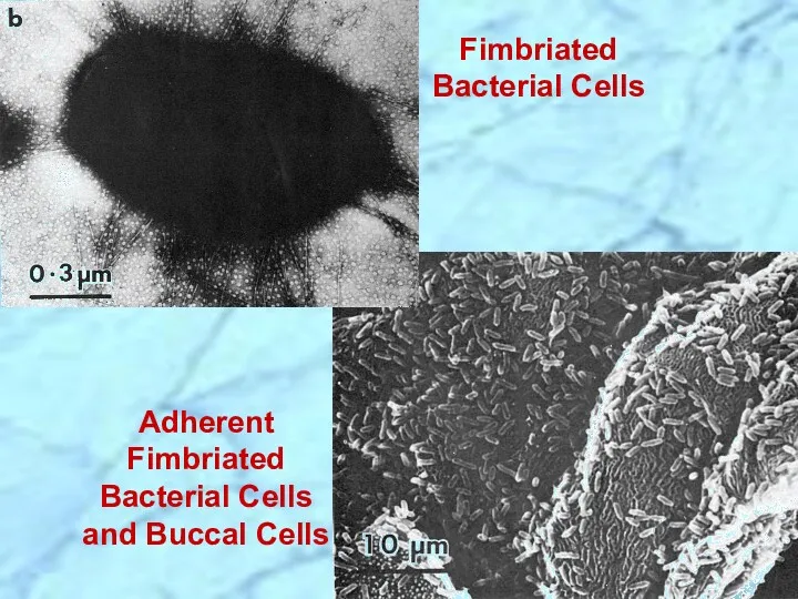 Adherent Fimbriated Bacterial Cells and Buccal Cells Fimbriated Bacterial Cells