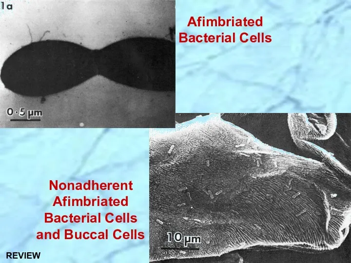 Afimbriated Bacterial Cells Nonadherent Afimbriated Bacterial Cells and Buccal Cells REVIEW