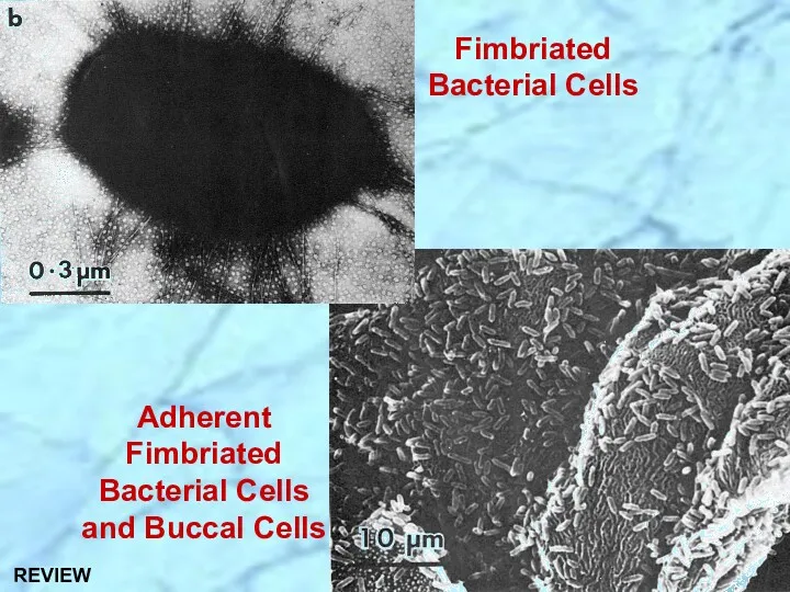 Adherent Fimbriated Bacterial Cells and Buccal Cells Fimbriated Bacterial Cells REVIEW