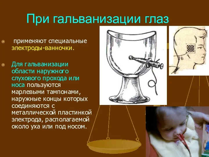 При гальванизации глаз применяют специальные электроды-ванночки. Для гальванизации области наружного