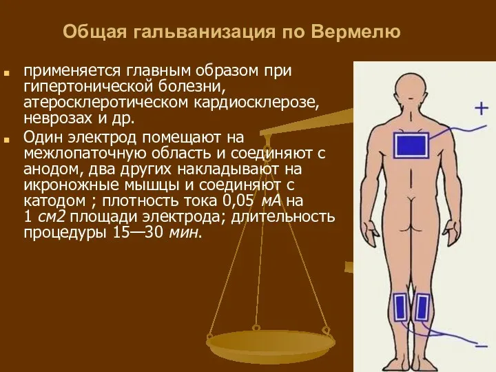 Общая гальванизация по Вермелю применяется главным образом при гипертонической болезни,