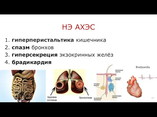 1. гиперперистальтика кишечника 2. спазм бронхов 3. гиперсекреция экзокринных желёз 4. брадикардия НЭ АХЭС