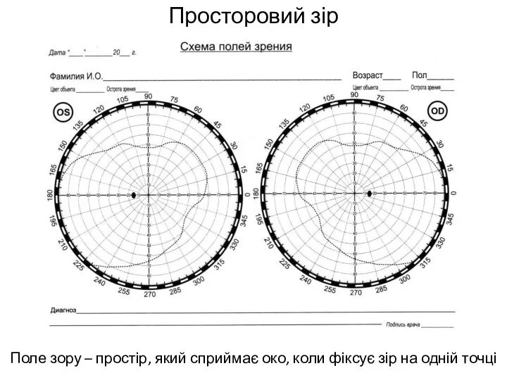 Просторовий зір Поле зору – простір, який сприймає око, коли фіксує зір на одній точці