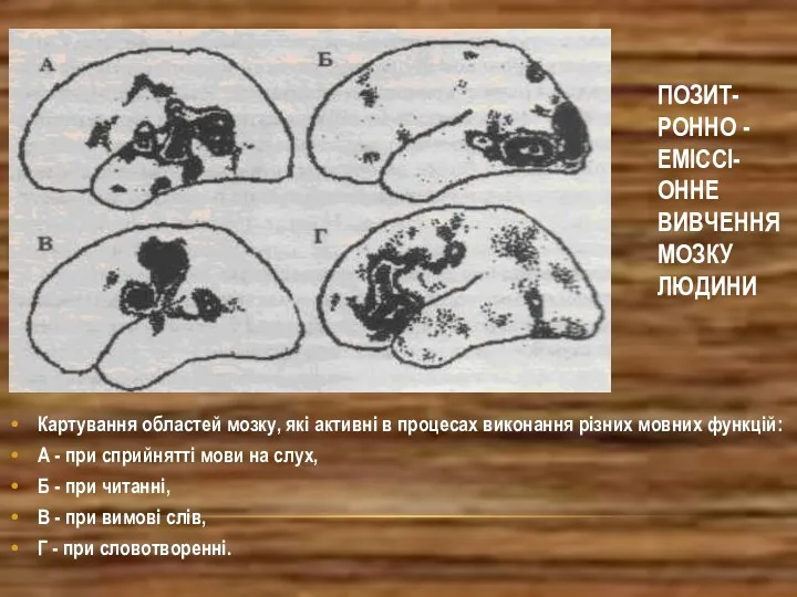 ПОЗИТ- РОННО - ЕМІССІ- ОННЕ ВИВЧЕННЯ МОЗКУ ЛЮДИНИ Картування областей