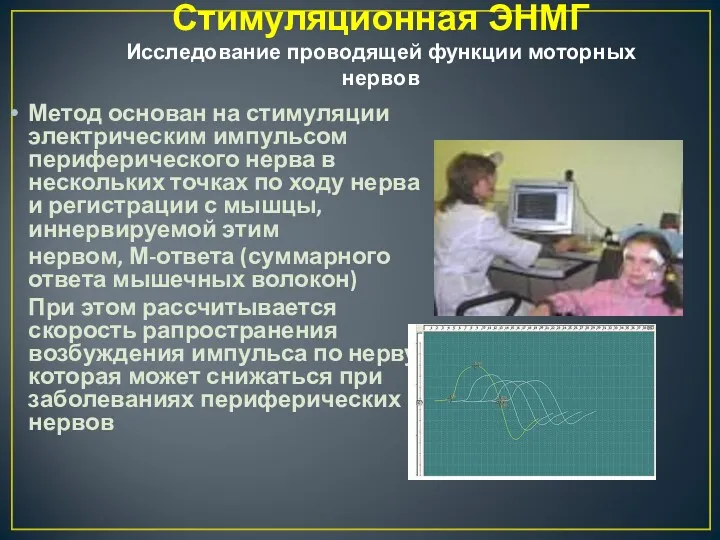 Стимуляционная ЭНМГ Исследование проводящей функции моторных нервов Метод основан на