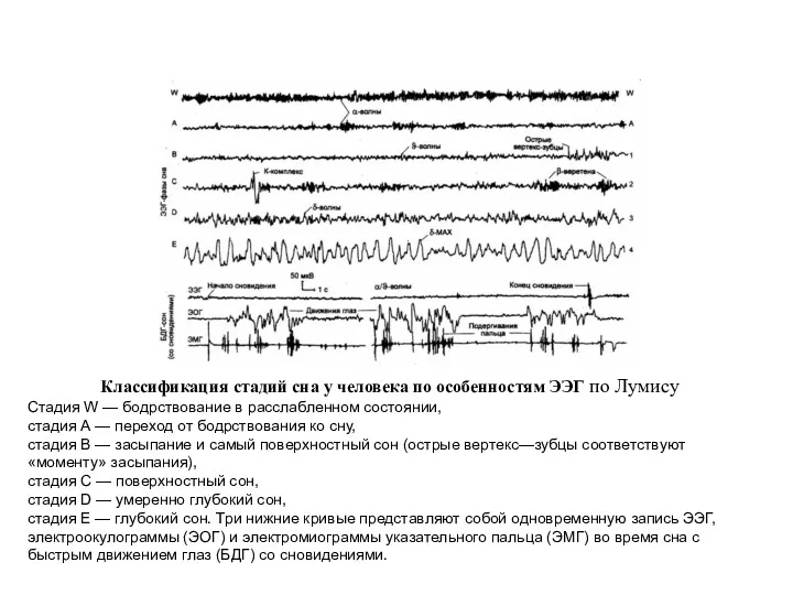 Классификация стадий сна у человека по особенностям ЭЭГ по Лумису