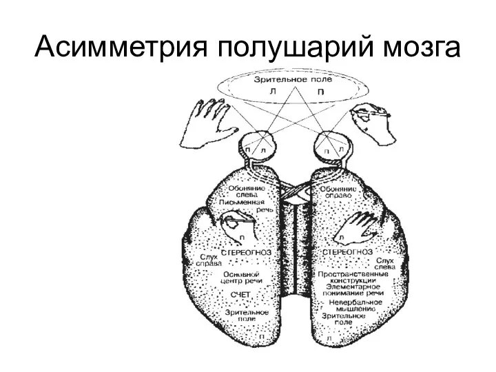 Асимметрия полушарий мозга