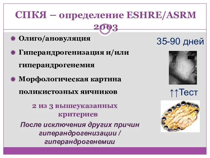 СПКЯ – определение ESHRE/ASRM 2003 Олиго/ановуляция Гиперандрогенизация и/или гиперандрогенемия Морфологическая