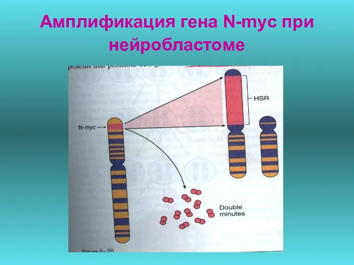 Амплификация гена N-myc при нейробластоме