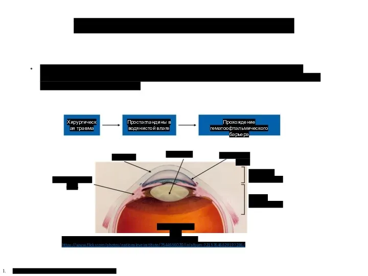 Послеоперационное воспаление (2/3) Romano V, et al. Mediators Inflamm. 2013;:971758