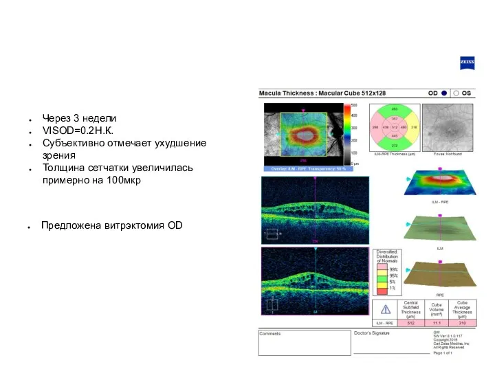 Через 3 недели VISOD=0.2Н.К. Субъективно отмечает ухудшение зрения Толщина сетчатки