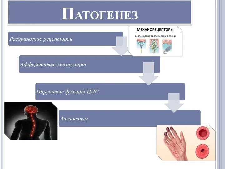 Патогенез