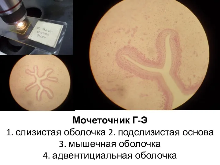 Мочеточник Г-Э 1. слизистая оболочка 2. подслизистая основа 3. мышечная оболочка 4. адвентициальная оболочка