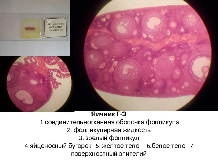 Яичник Г-Э 1 соединительнотканная оболочка фолликула 2. фолликулярная жидкость 3.