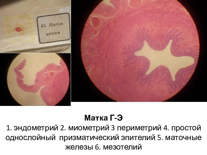 Матка Г-Э 1. эндометрий 2. миометрий 3 периметрий 4. простой