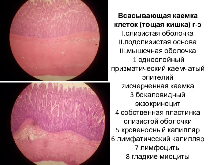 Всасывающая каемка клеток (тощая кишка) г-э I.слизистая оболочка II.подслизистая основа