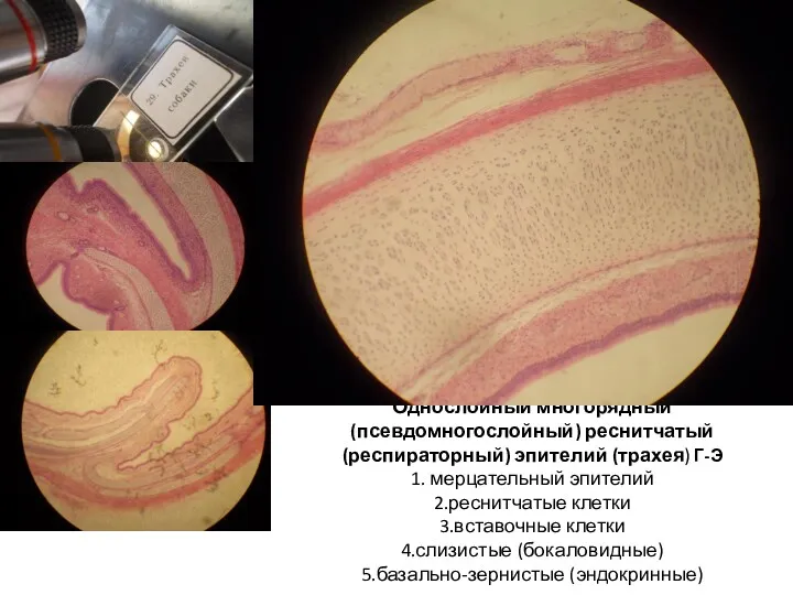 Однослойный многорядный (псевдомногослойный) реснитчатый (респираторный) эпителий (трахея) Г-Э 1. мерцательный