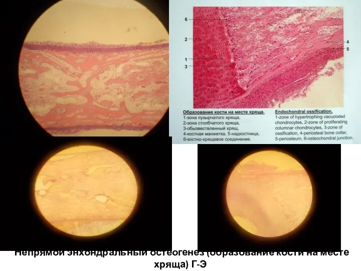 Непрямой энхондральный остеогенез (образование кости на месте хряща) Г-Э