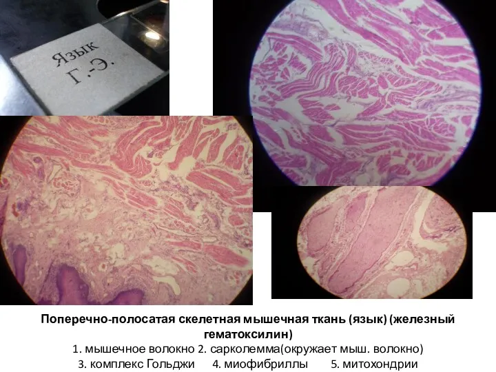 Поперечно-полосатая скелетная мышечная ткань (язык) (железный гематоксилин) 1. мышечное волокно