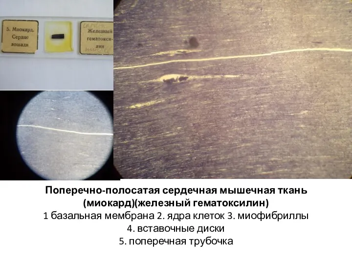 Поперечно-полосатая сердечная мышечная ткань (миокард)(железный гематоксилин) 1 базальная мембрана 2.