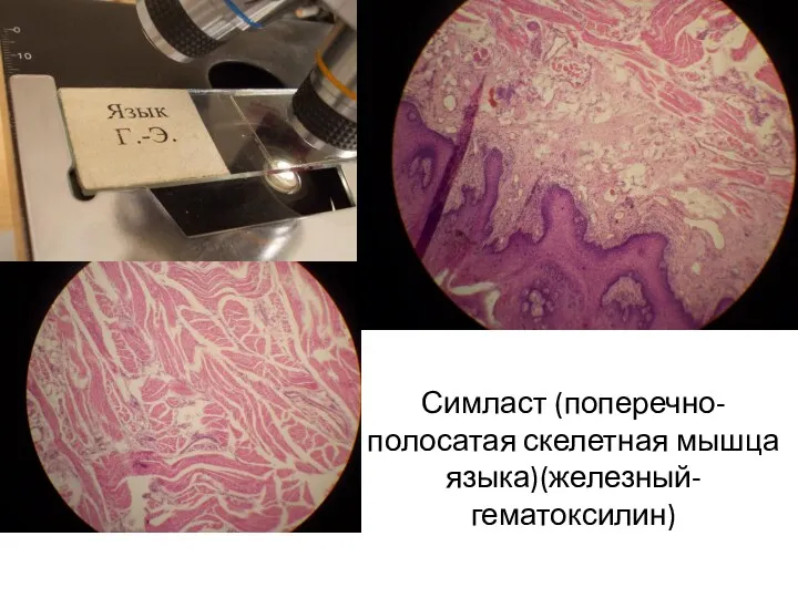 Симласт (поперечно-полосатая скелетная мышца языка)(железный-гематоксилин)