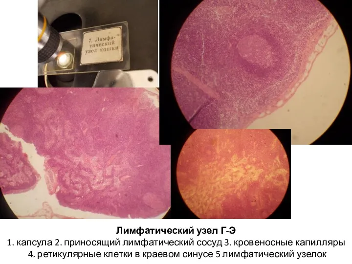 Лимфатический узел Г-Э 1. капсула 2. приносящий лимфатический сосуд 3.