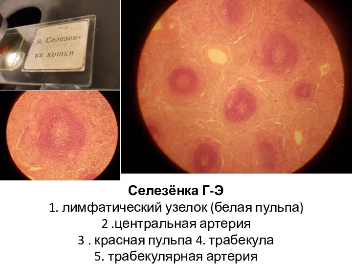 Селезёнка Г-Э 1. лимфатический узелок (белая пульпа) 2 .центральная артерия