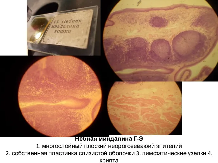 Нёбная миндалина Г-Э 1. многослойный плоский неороговеваюий эпителий 2. собственная