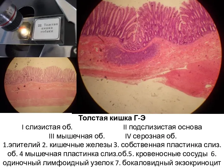 Толстая кишка Г-Э I слизистая об. II подслизистая основа III