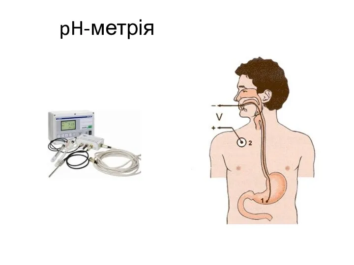 pH-метрія