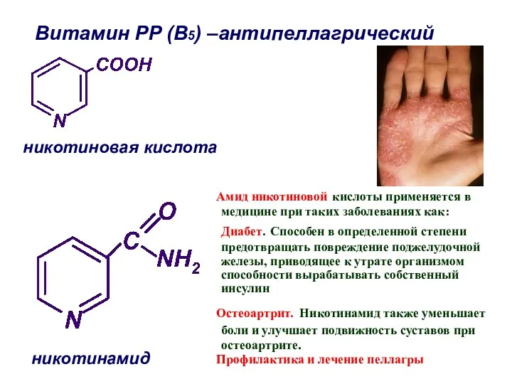 никотиновая кислота никотинамид Витамин РР (В5) –антипеллагрический Амид никотиновой кислоты