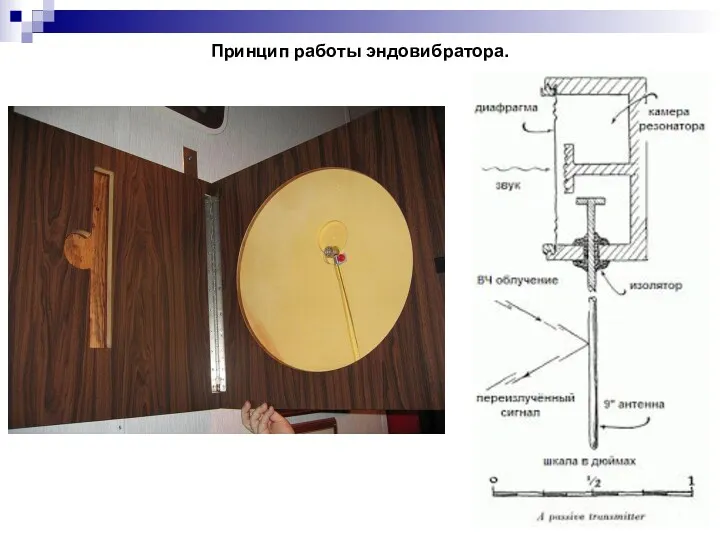 Принцип работы эндовибратора.