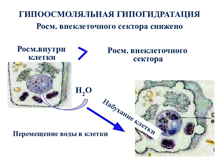 ГИПООСМОЛЯЛЬНАЯ ГИПОГИДРАТАЦИЯ Росм. внеклеточного сектора снижено Росм.внутри клетки Н2О Росм.