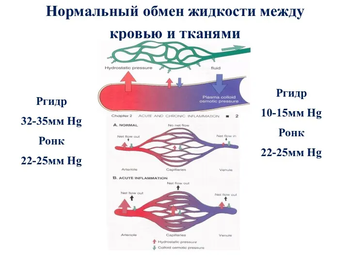 Нормальный обмен жидкости между кровью и тканями Ргидр 32-35мм Hg