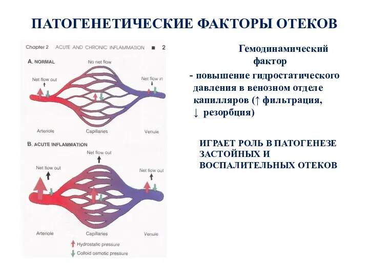 ПАТОГЕНЕТИЧЕСКИЕ ФАКТОРЫ ОТЕКОВ Гемодинамический фактор - повышение гидростатического давления в