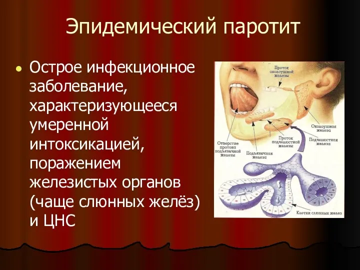 Эпидемический паротит Острое инфекционное заболевание, характеризующееся умеренной интоксикацией, поражением железистых органов (чаще слюнных желёз) и ЦНС
