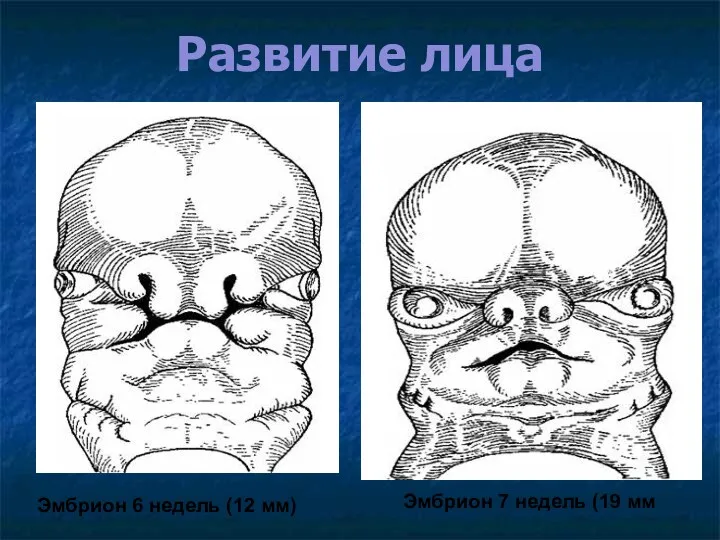 Развитие лица Эмбрион 6 недель (12 мм) Эмбрион 7 недель (19 мм