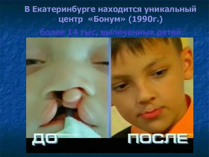 В Екатеринбурге находится уникальный центр «Бонум» (1990г.) более 14 тыс. вылеченных детей