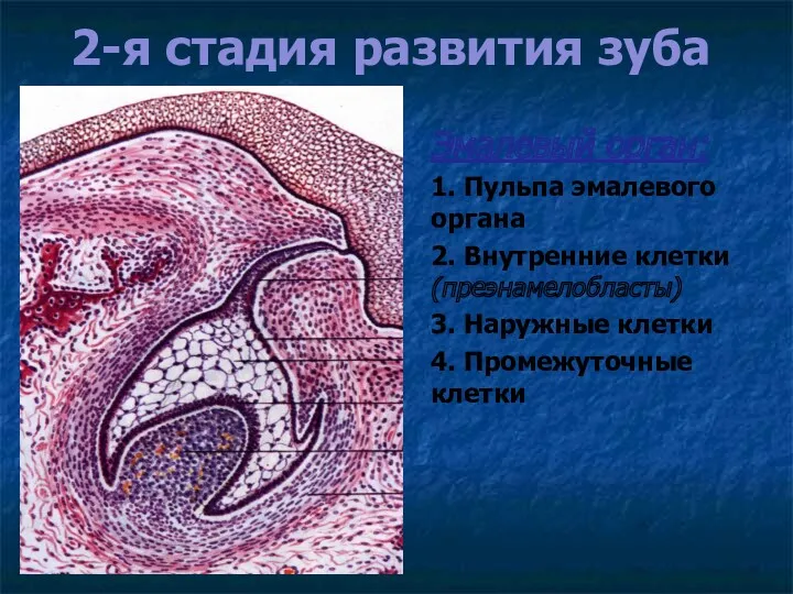 2-я стадия развития зуба Эмалевый орган: 1. Пульпа эмалевого органа