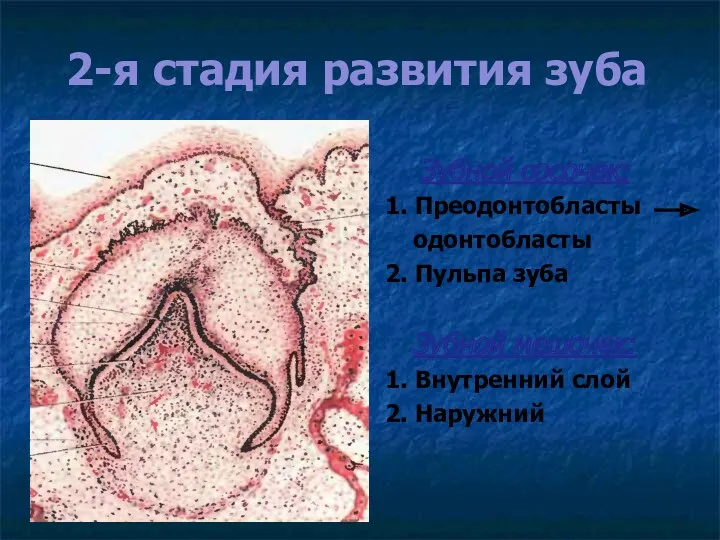 2-я стадия развития зуба Зубной сосочек: 1. Преодонтобласты одонтобласты 2.