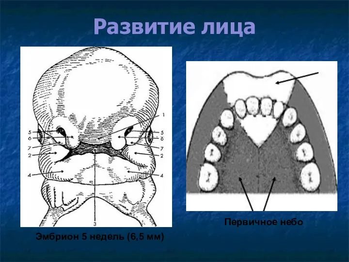 Развитие лица Первичное небо Эмбрион 5 недель (6,5 мм)