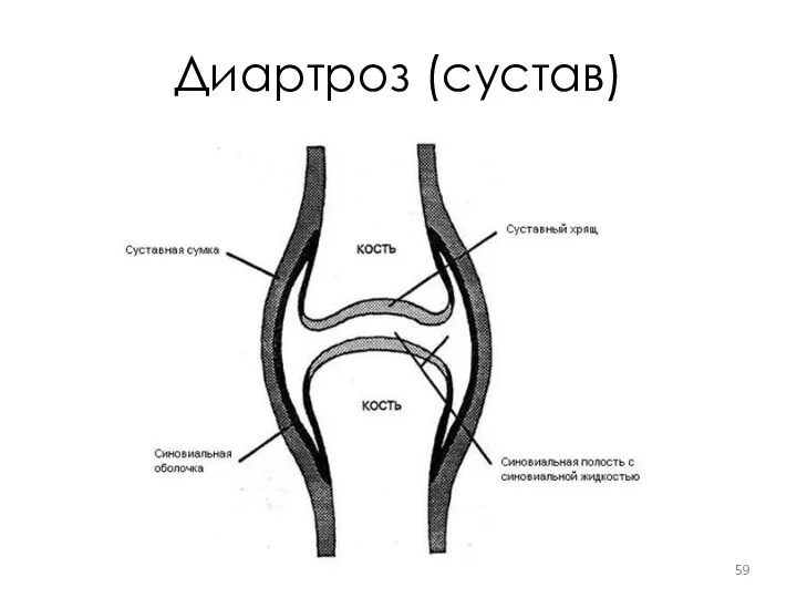 Диартроз (сустав)